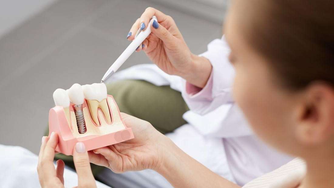 How Can Implants Improve My Smile? Dental Implants Teaneck NJ