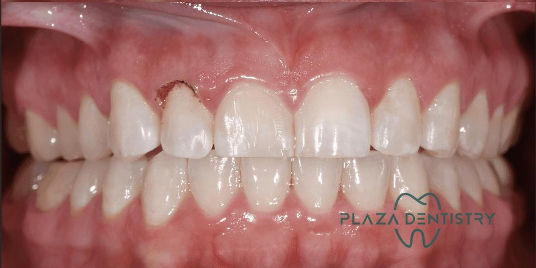 smile after dental treatment | cosmetic dentist teaneck nj